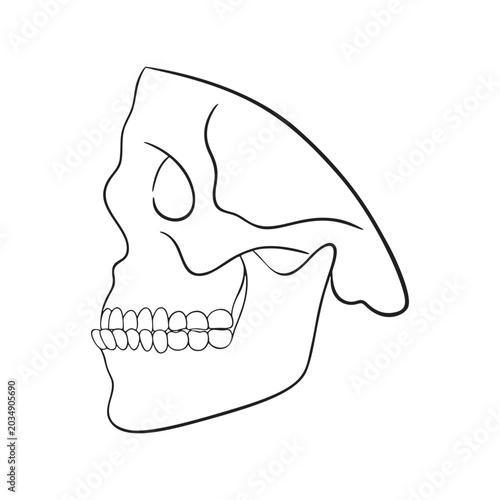 Underbite Illustration