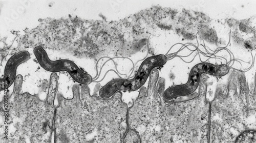 Helicobacter pylori Urease Activity, Stomach Mucosa Biopsy TEM