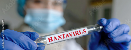 Hantavirus illustration, AI generated