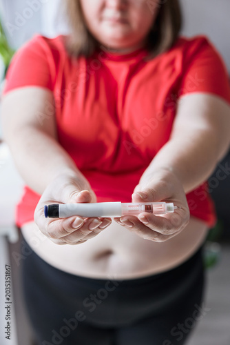 Woman with obesity holding an insulin pump in front of her belly