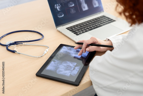Foto Female doctor reviewing digital x-ray images on tablet in clinic