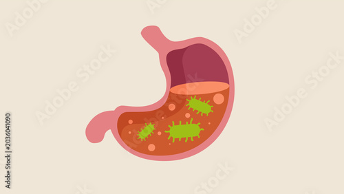 Bild auf Leinwand Gastroenteritis Stomach Infection Illustration with Bacteria Concept