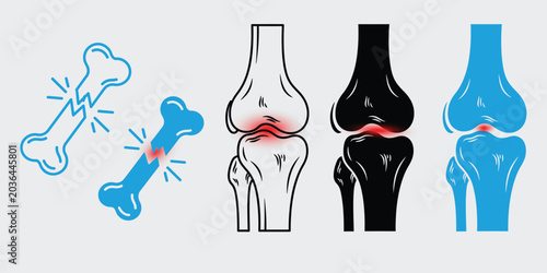 Bild auf Leinwand Joint pain icon set with fractured bone and inflammation medical illustration