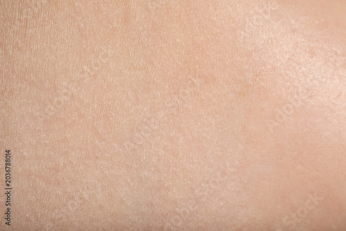 Photos Texture of normal skin as background, closeup