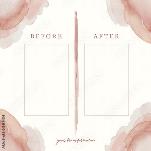 Before And After Beauty Template