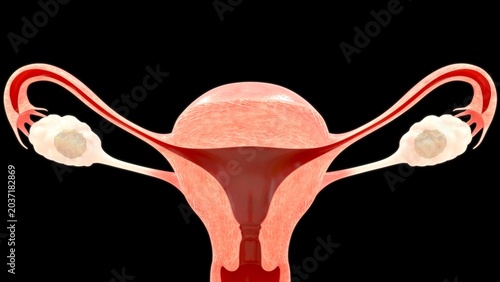 Cross-Section of an Ovary with a Tumor or Cyst