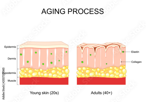 Foto Aging process