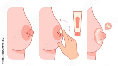 Visual guide showing a hand applying lanolin cream on the nipple for postpartum care and recovery during the fourth trimester.