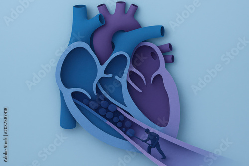 Medical concept showing cut paper style heart with blue and purple tones. small figure clearing blocked artery, hopeful visualization of cardiovascular treatment and recovery