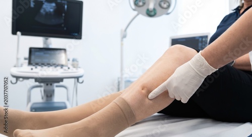 Doctor assessing leg edema and venous insufficiency