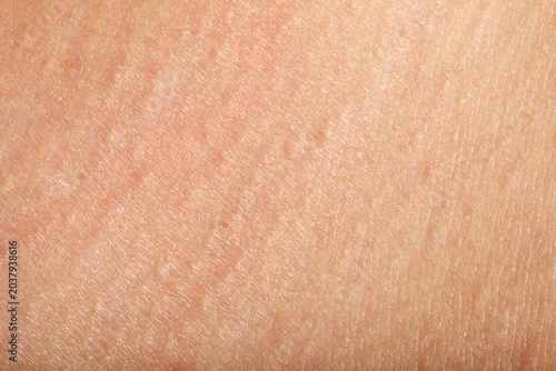 Fotografie Texture of normal skin as background, closeup