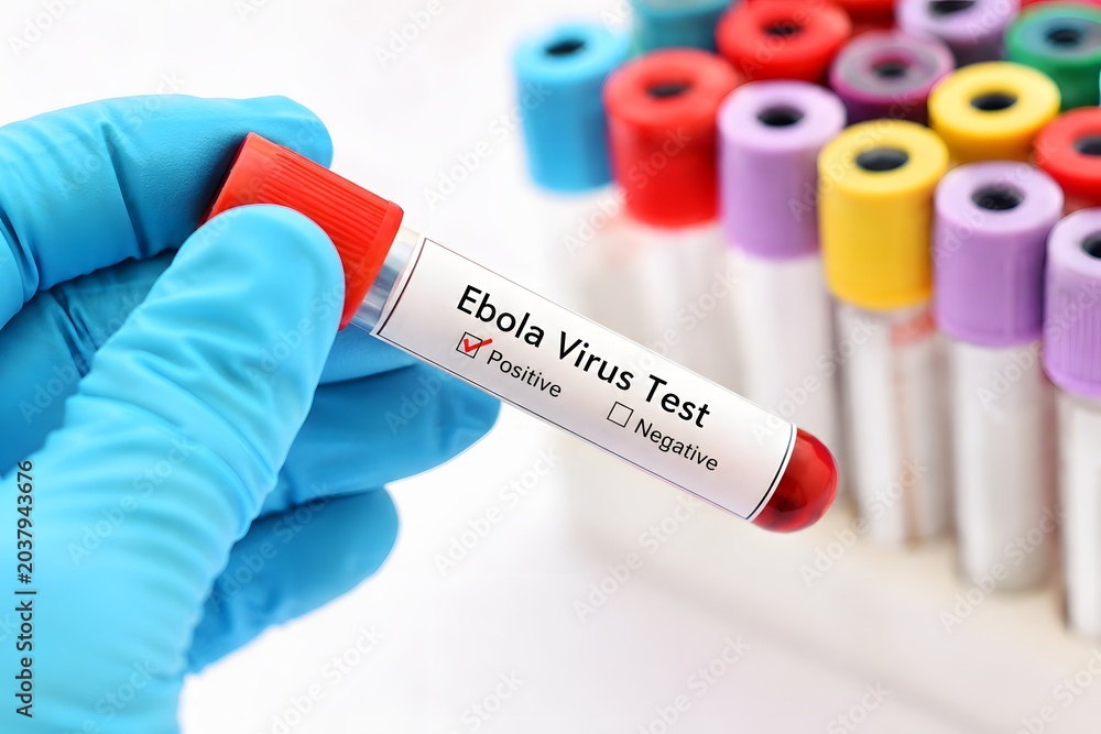 Obraz premium Ebola virus test tube positive result for the concept of medical research and epidemic.