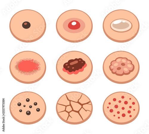 Assorted skin issues and concerns such as a variety of rashes, moles, acne, blisters, burns, and ongoing medical conditions