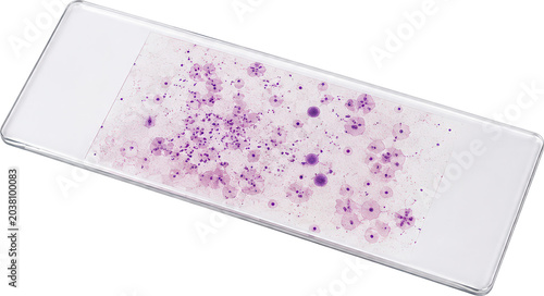 Hantavirus Transparent Microscopic Slide Sample for Medical Laboratory Research