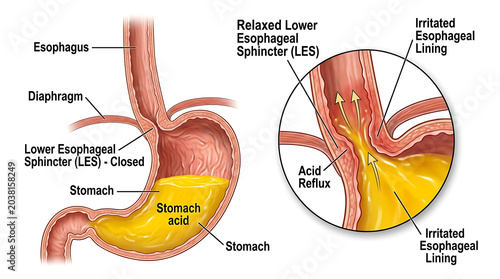 Anatomy of the esophagus and stomach