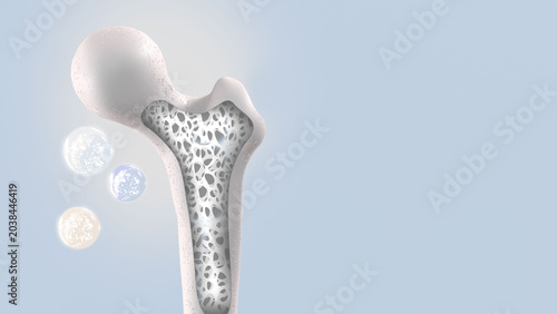 Fotografía Osteoporosis, knee joint maintenance, and prevention of bone degeneration