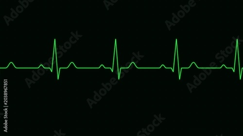 heart rate monitor ekg line pulse overlay effect