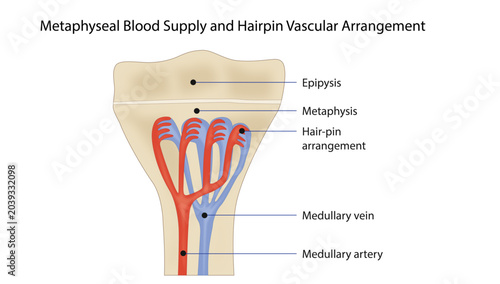 Schilderij op canvas Metaphyseal Blood Supply and Hairpin Vascular Arrangement with the characteristic hairpin vascular arrangement near the growth plate