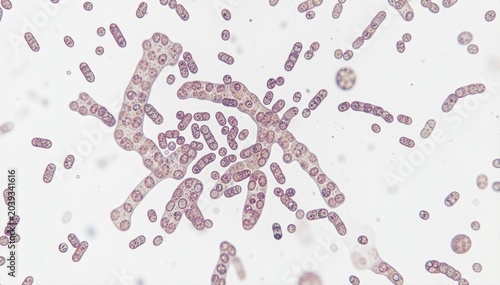 Microscopic view of Candida Albicans: Close-up, high-magnification view of Candida albicans yeast cells, showing their characteristic budding and hyphae formation, under a microscope.