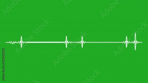 Animated heartbeat line on a green screen background for medical and health concepts