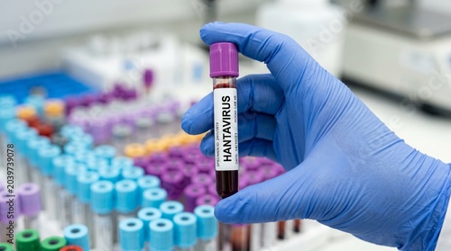 Close up of a gloved hand holding a medical blood test tube with a Hantavirus label in a laboratory setting, medical research and diagnostics concept.