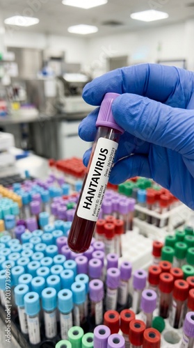Close up of a gloved hand holding a medical blood test tube with a Hantavirus label in a laboratory setting, medical research and diagnostics concept.