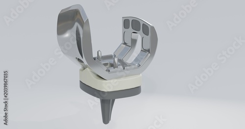 3d illustration of a generic knee prosthesis