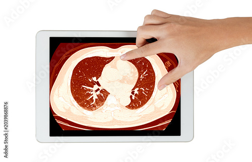 Hand touching CT scan of chest displayed on tablet screen with warm orange tone, showing lung and mediastinum cross-section, isolated on white background. Digital radiology and telemedicine concept.