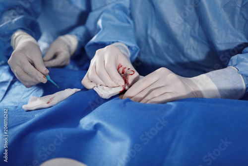 Bild auf Leinwand Surgery on blood vessels