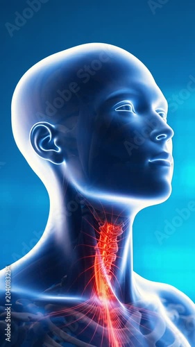 Human 3D head and neck anatomy model profile view showing glowing red painful cervical spine and nerve inflammation