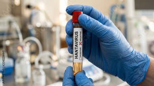 Gloved hands holding a blood sample test tube labeled negative for Hantavirus in a laboratory setting, medical research concept.