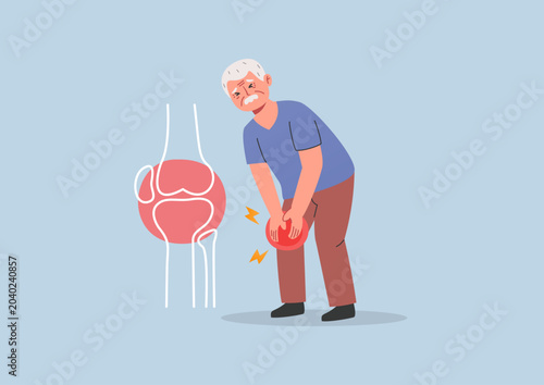 фотографія Elderly man suffering from severe knee pain with an anatomical joint diagram showing osteoarthritis