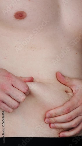 Excess belly fat in a young man.
Demonstration of obesity problems caused by overeating calories.