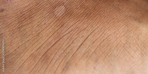 Schilderij op canvas the texture of the skin on the feet of men with brown skin, with lines and wrink