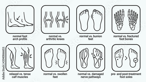 Bild auf Leinwand Medical illustrations comparing normal and abnormal human body parts