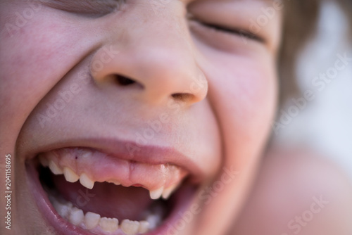 Fotografija Close-up of a happy kid giggling with open mouth, focusing on his dental growth and missing upper primary teeth