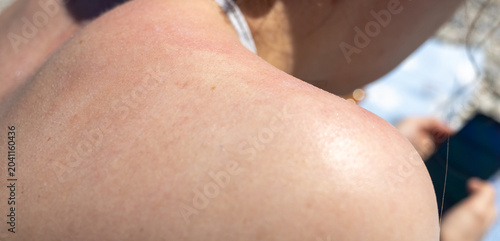 Schilderij op canvas Woman sunbathing on a beach with sunscreen lotion applied on her back