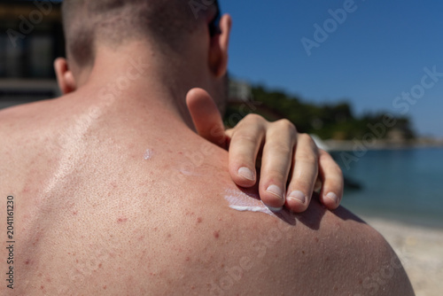 Photos man sunbathing on a beach with sunscreen lotion applied on his back