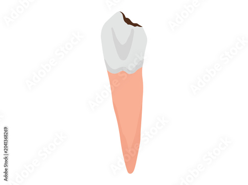 Hand Drawn Human Dental Decay
