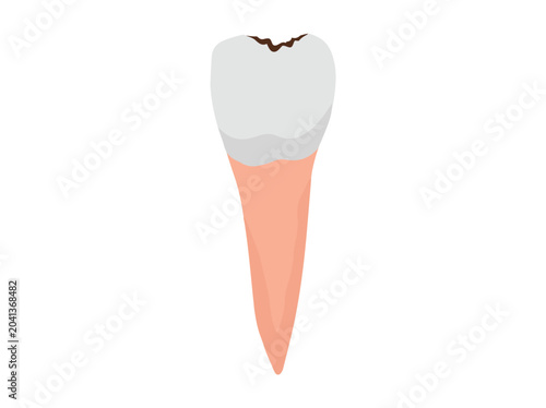 Hand Drawn Human Dental Decay