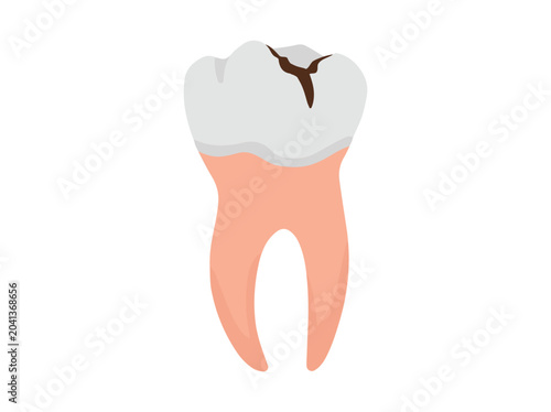 Human Tooth Cavity Clip Art