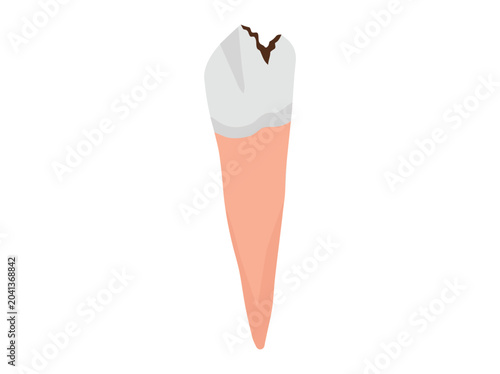 Human Tooth Cavity Clip Art