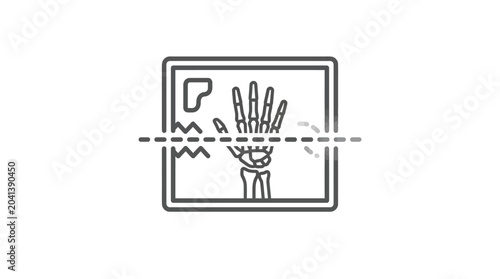 Medical X-ray scan of a human hand diagnostic.