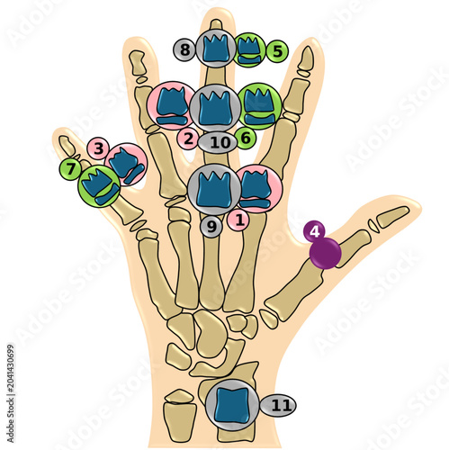 Konstfotografi Skeletal Maturity Assessment and Dental Age Correlation Map
