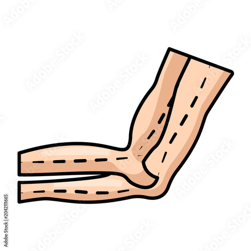 arm bent at the elbow with dashed contour lines running along the upper and lower arm concept, loose skin removal after weight loss vector icon design, plastic surgery procedure stock illustration