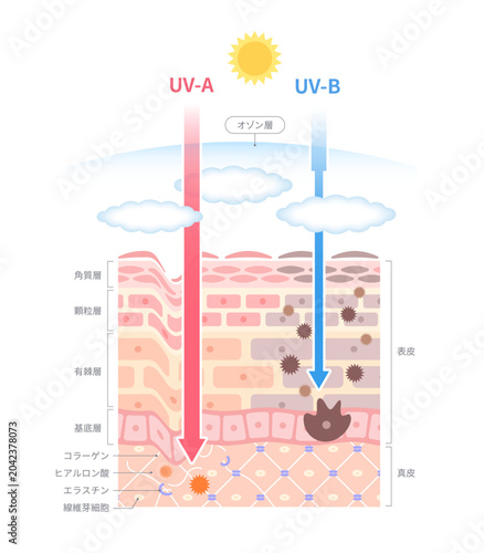 UVAとUVBの紫外線ダメージがオゾン層を突き抜けて肌にダメージを与えている肌断面図イラスト
