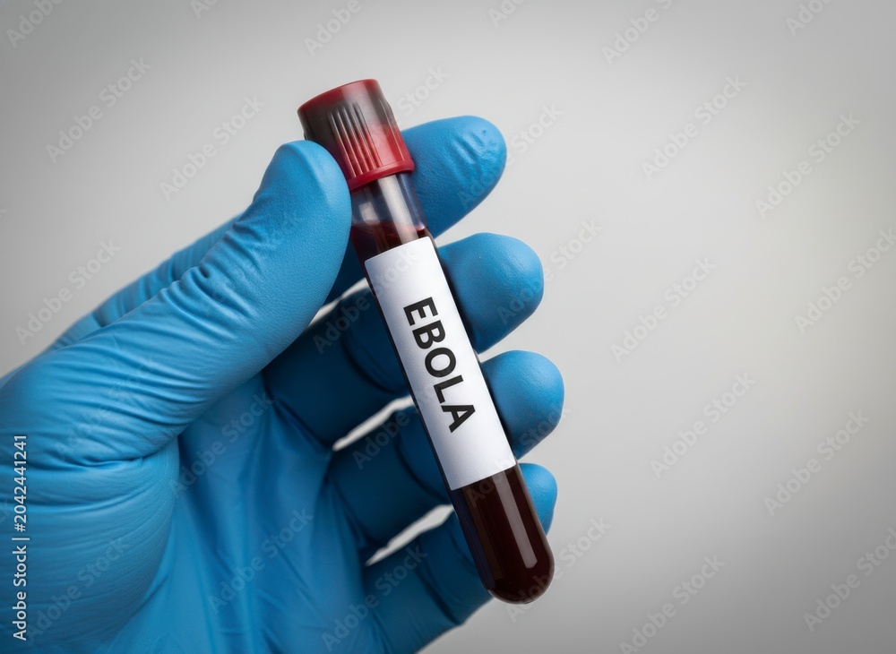 Obraz premium Ebola Blood Sample in Laboratory Hand with Blue Glove