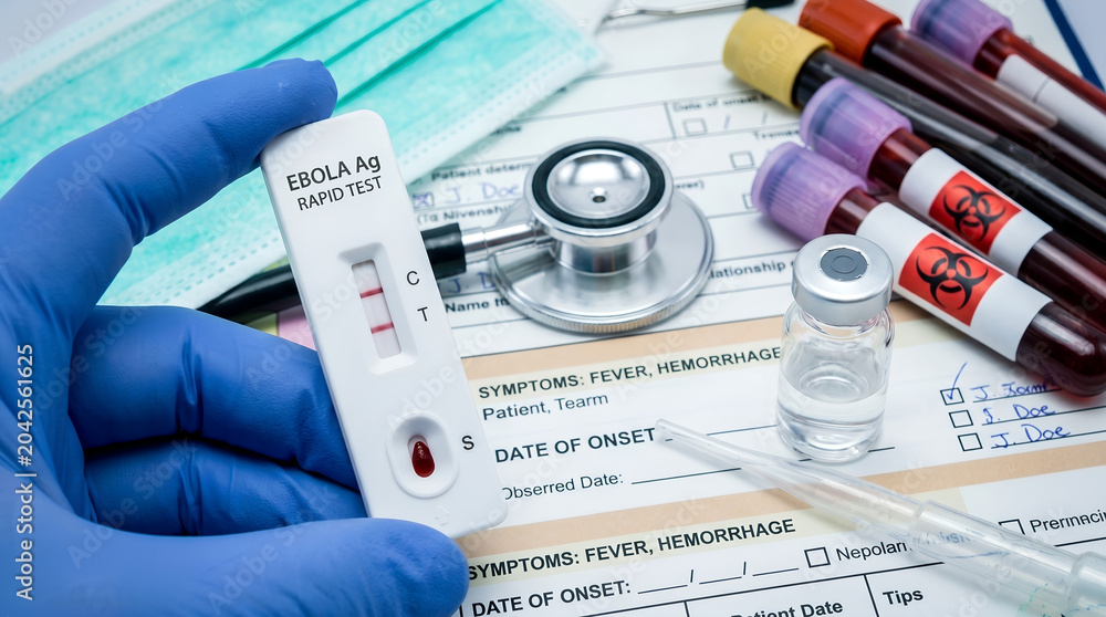 Fototapeta premium Gloved Hand Holding Ebola Ag Rapid Test Kit with Positive Result Showing Two Red Lines Next to Stethoscope and Biohazard Blood Tubes Medical Concept