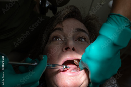 Εκτύπωση καμβά Patient receiving a local anesthetic injection prior to root canal treatment in a dental clinic