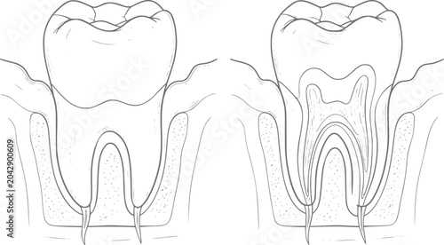 Cuadro en lienzo Anatomical of a human molar tooth showing internal structure and root canal anat